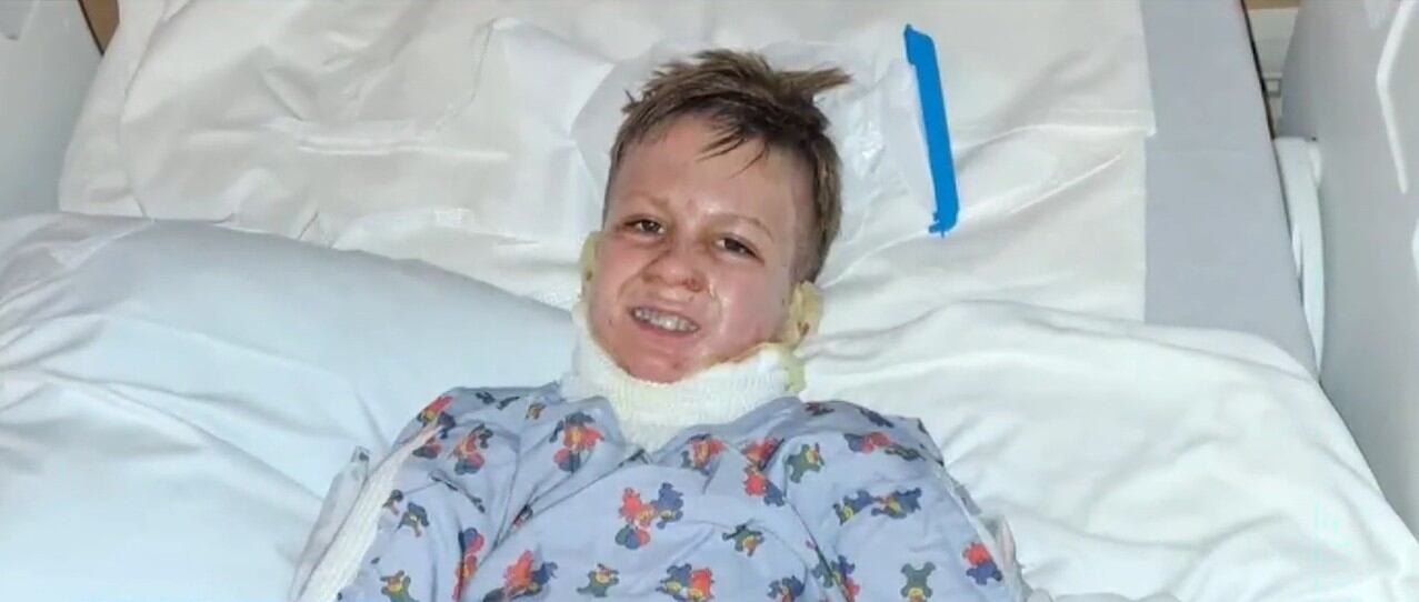 Tabletop Fire Pit Explodes, Injuring Child During Family Vacation