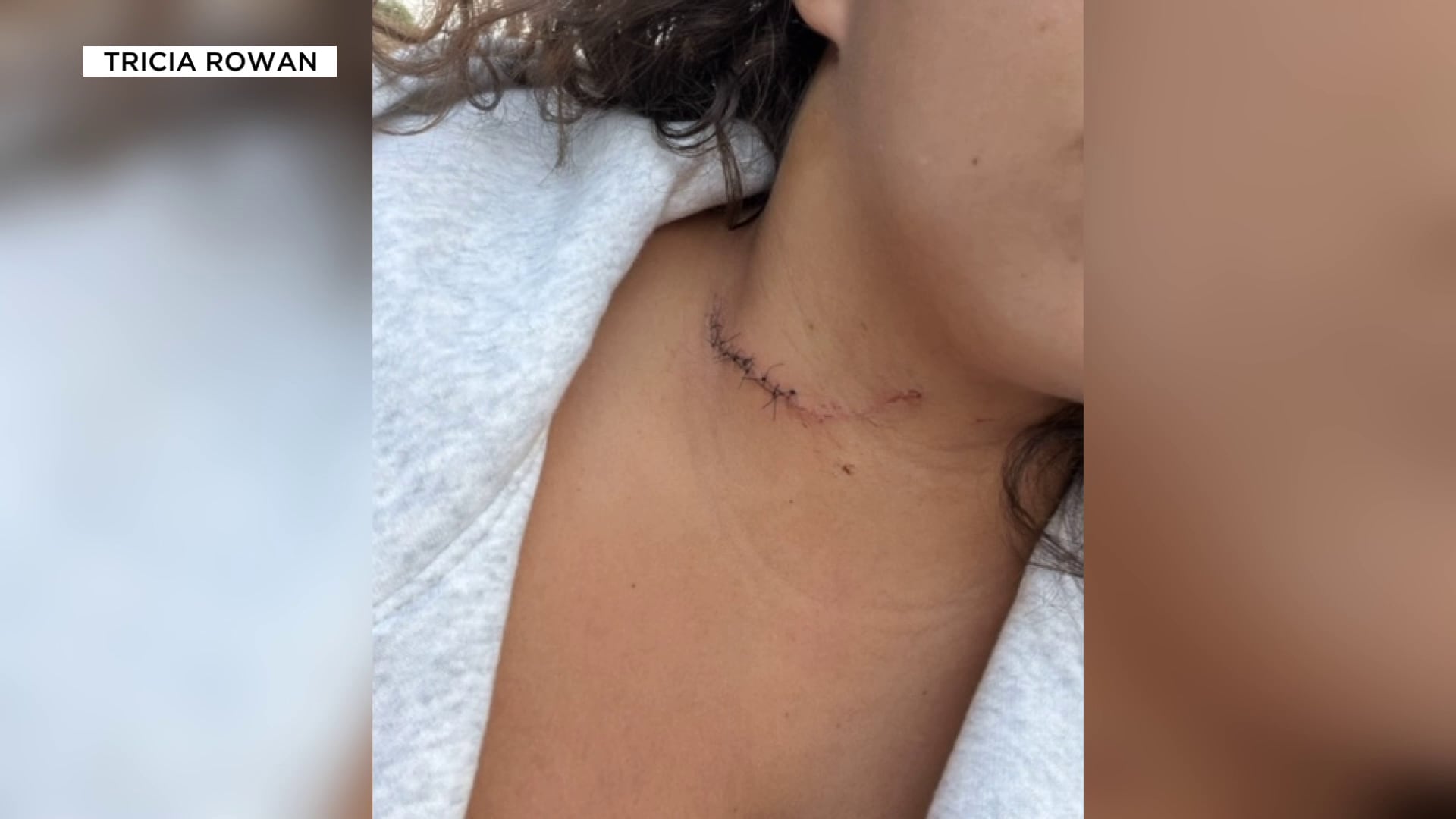 Woman Attacked After Asking for Directions on Havasupai Falls Birthday Trip; Suspect Arrested
