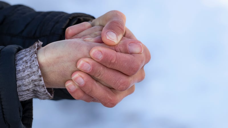 Red hands in the cold.Risk of frostbite of hand or fingers outdoors during cold weather...
