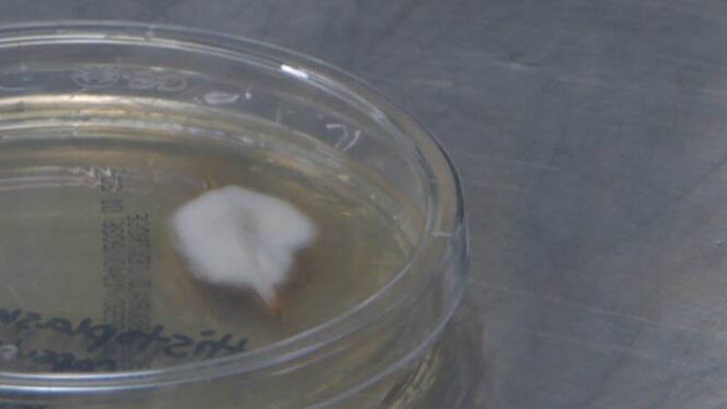 Nashville boy living with rare complication from histoplasmosis, fungal infection rising in...